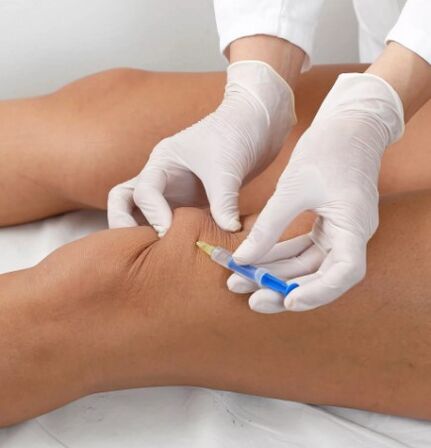 Ozon therapy