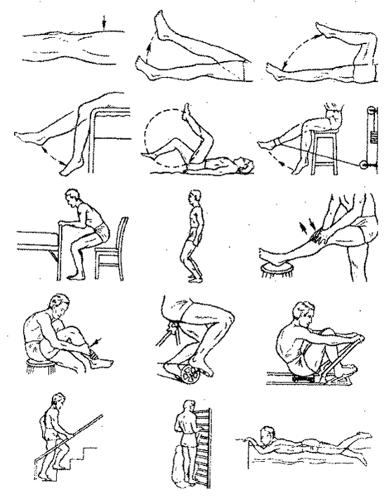 Therapeutic exercises for knee articulation arthrosis