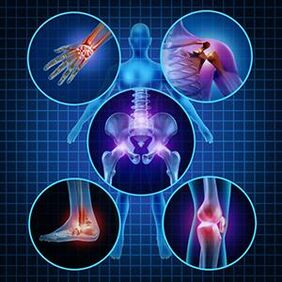 How to facilitate the mobility of joints with arthritis and arthrosis in treatment