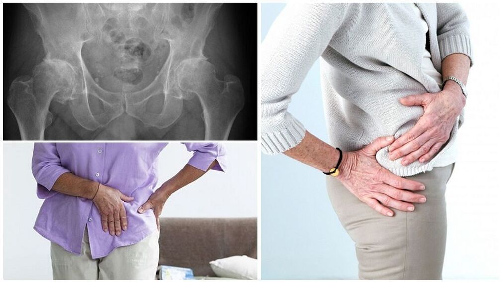 There are many reasons why the pathology develops